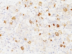 FSH beta Antibody (SPM107), Novus Biologicals 0.2mg; Unlabeled:Antibodies,